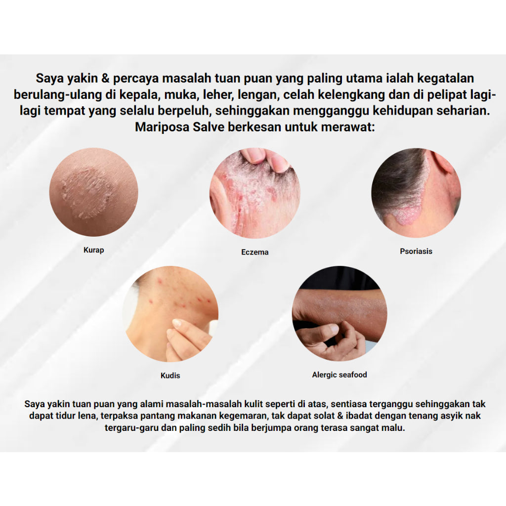 [MARIPOSA] Organic Herbal Salve Moisturizer - Kulit Gatal Eczema Psoriasis Kurap Black 30g Gold 50g Soap
