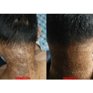 [MARIPOSA] Organic Herbal Salve Moisturizer - Kulit Gatal Eczema Psoriasis Kurap Black 30g Gold 50g Soap