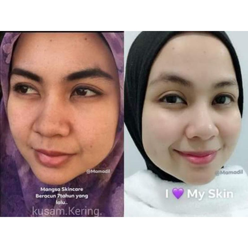[MAMADIL] MEDIL SKINCARE Soft Cleanser Perfect Sleeping Serum Whipped Foundation complete skin care