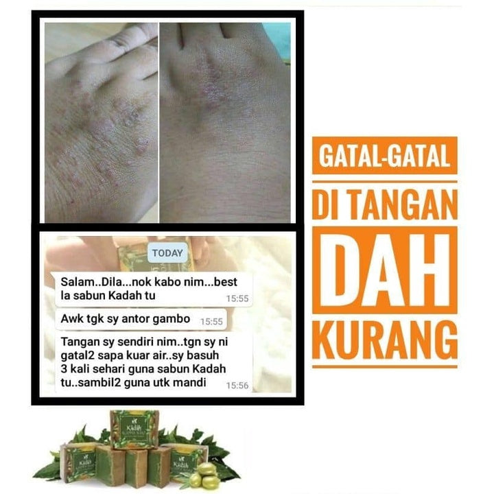 [YASALMA] [KADAH] YASALMA ALEPPO SOAP Sabun Minyak Zaitun Olive Ghar 5% |10% | 40% | 78% LAUREL