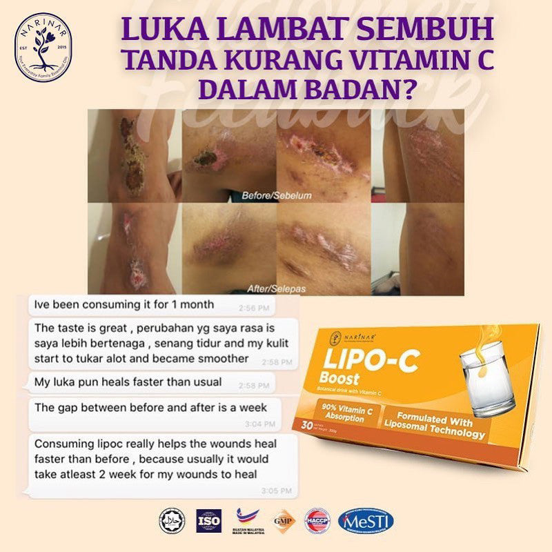 NARINAR LIPO C BOOST Liposomal Vitamin C | Botanical Drink | Made in Malaysia