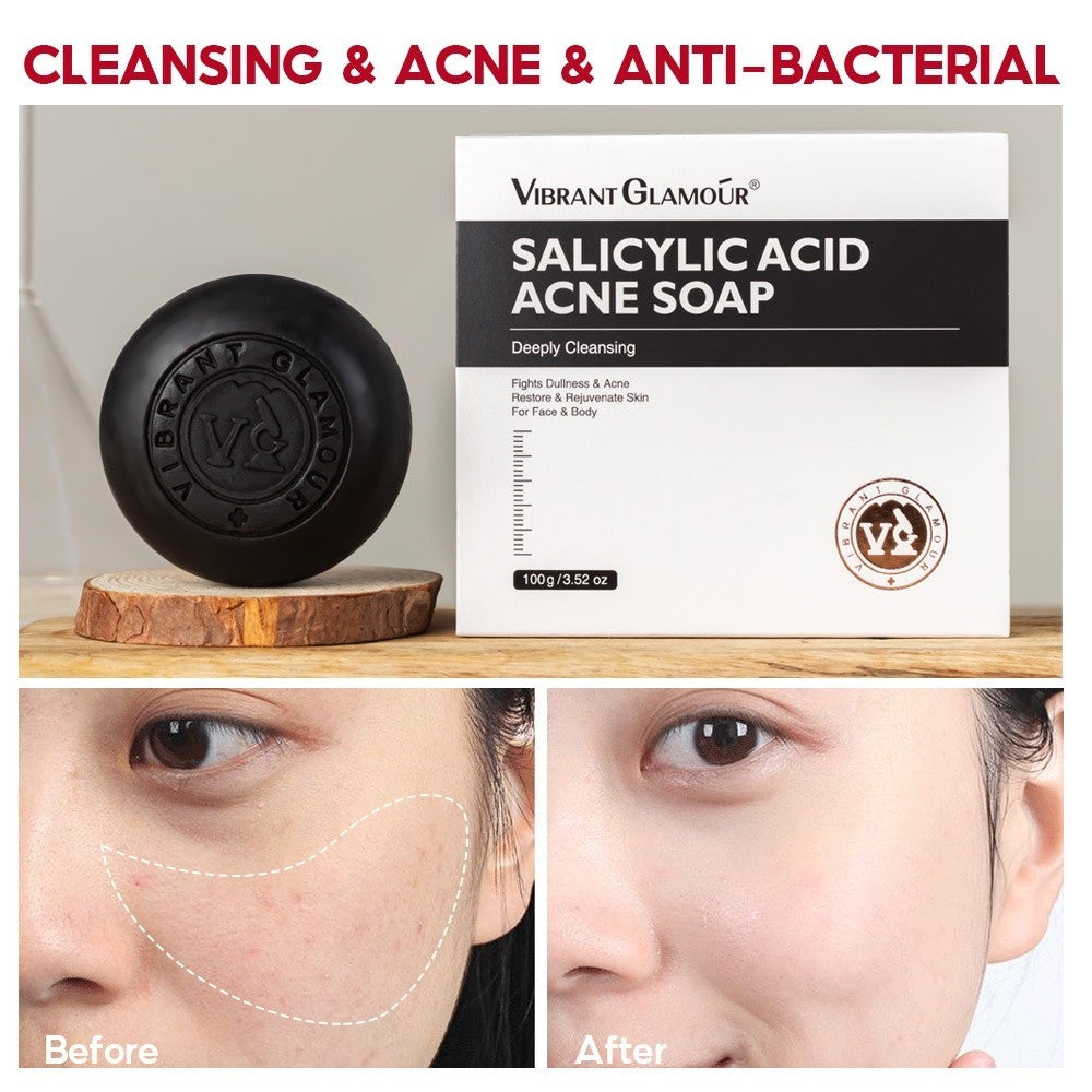 [VIBRANT GLAMOUR] Salicylic Acid Acne Soap Treatment Pore Exfoliating Foam Face Body