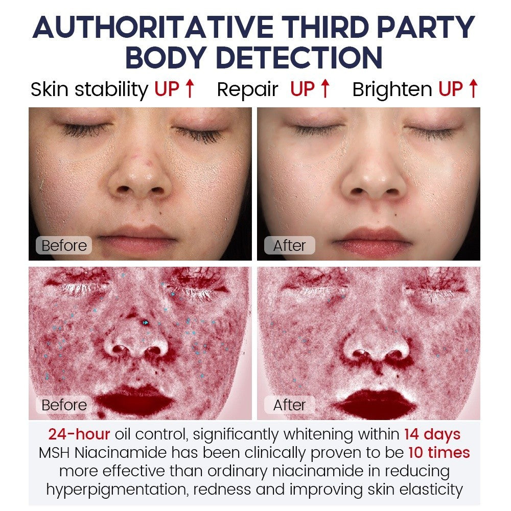 [VIBRANT GLAMOUR] 2% Niacinamide MOISTURIZER 5X Ceramide Skin Barrier Repair