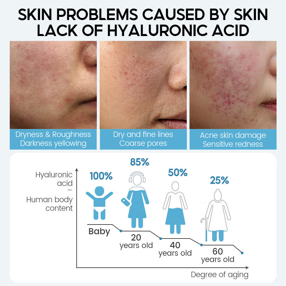 [VIBRANT GLAMOUR] Hyaluronic Acid Serum Anti-Aging Whitening Moisturizing Acne Plump