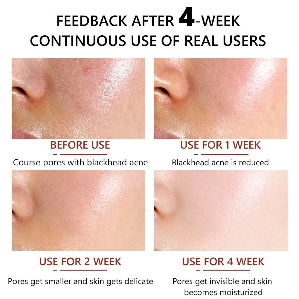 [VIBRANT GLAMOUR] Pore Minimizer Serum BHA Salicylic Acid Blackheads Remover Smooth