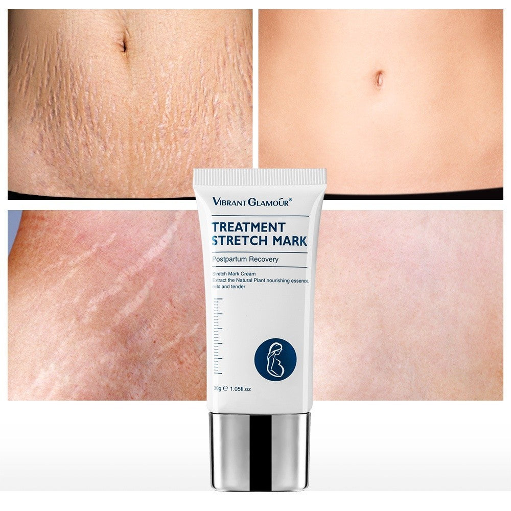[VIBRANT GLAMOUR] TREATMENT STRETCH MARK Remover Cream Maternity Repair pregnancy