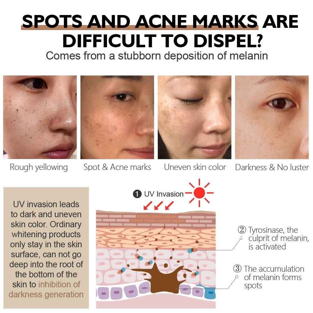 [VIBRANT GLAMOUR] A-Arbutin Whitening LOTION Dark Spot Corrector Moisturize Regenerate