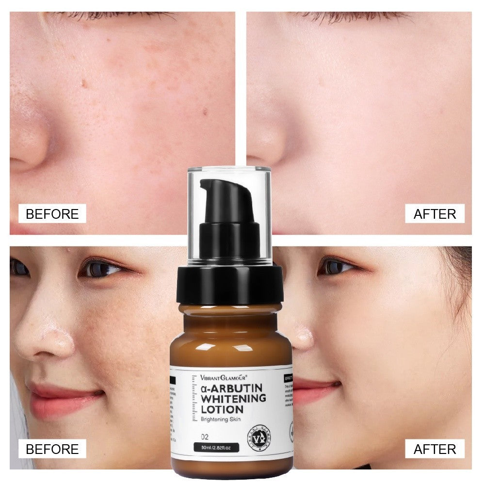 [VIBRANT GLAMOUR] A-Arbutin Whitening LOTION Dark Spot Corrector Moisturize Regenerate
