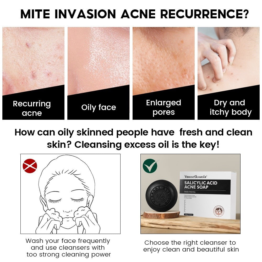 [VIBRANT GLAMOUR] Salicylic Acid Acne Soap Treatment Pore Exfoliating Foam Face Body