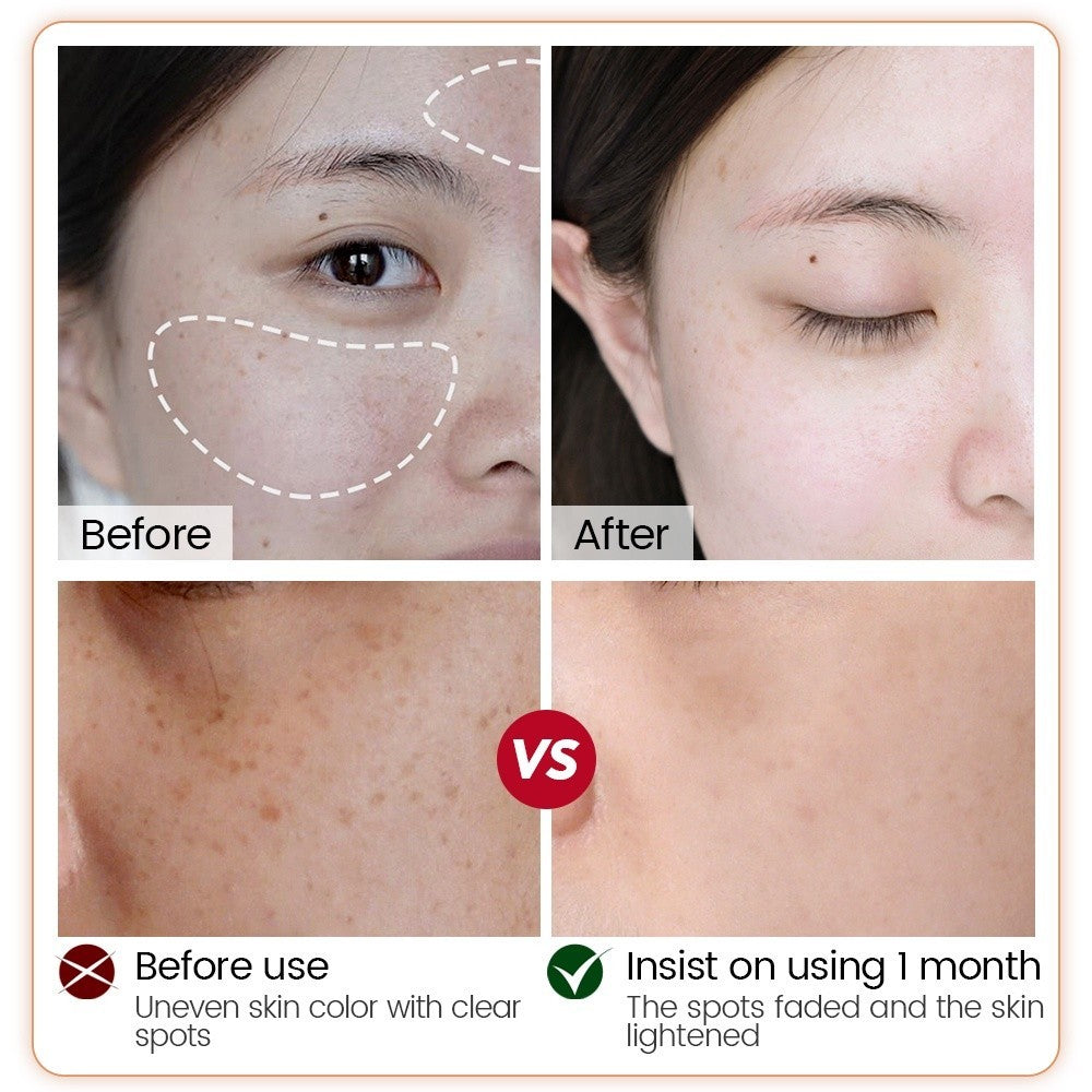 [VIBRANT GLAMOUR] A-Arbutin Whitening SERUM Niacinamide 10% Bleaching Facial Essence